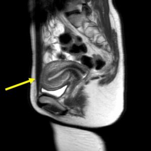 脳ドック  ご利用案内  吾妻脳神経外科循環器科