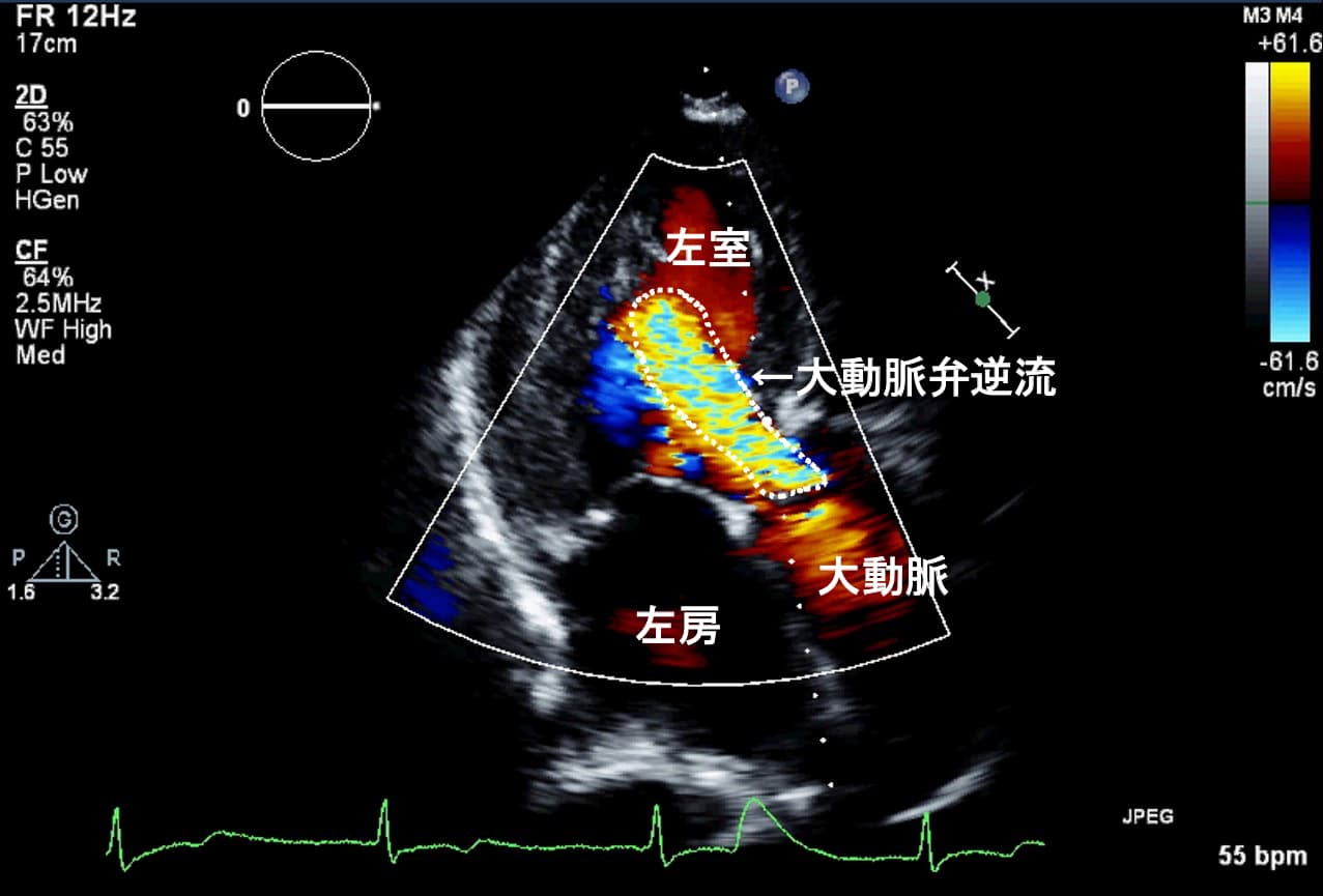 テスト結果は何を意味しますか?
