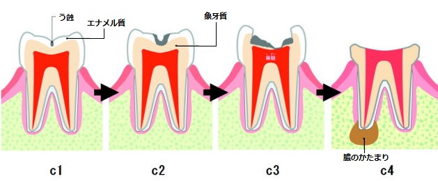 歯科に関係する病気のお話し | 沼田クリニック歯科