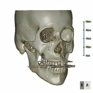 ３Ｄで表示することができ、好きな方向へ回転でき、任意の場所の割断面も表示できます。